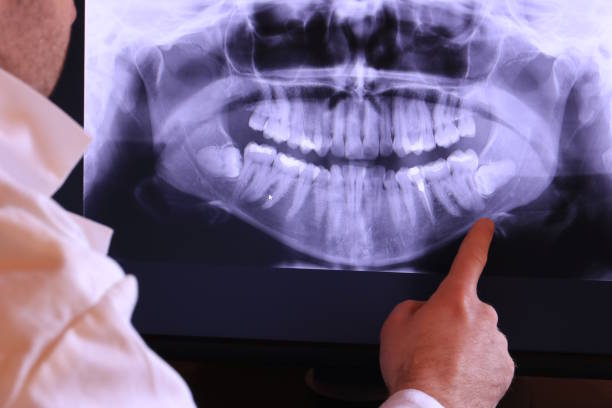 Best Pediatric Emergency Dentist in Junction City, OR