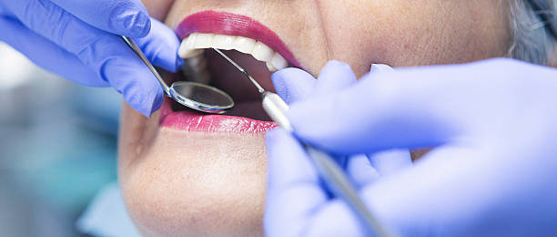 Best Cosmetic Emergency Dentistry in Junction City, OR